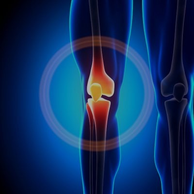 Salud Articular